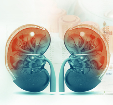 Acute kidney Failure image 2